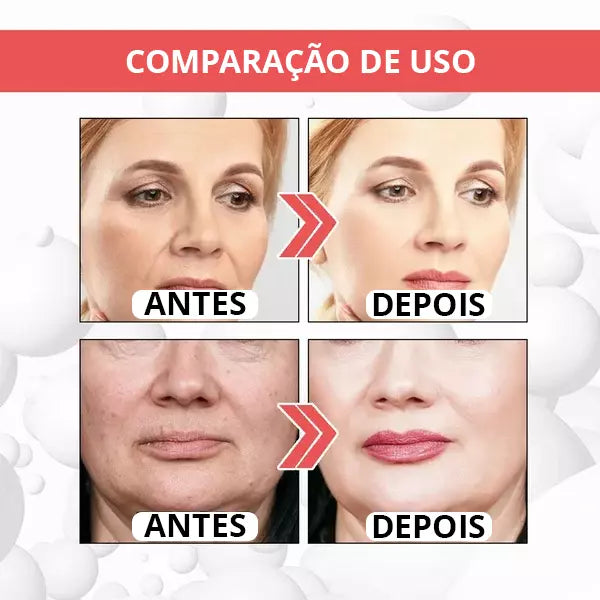 Botox-UP Sérum Anti-idade